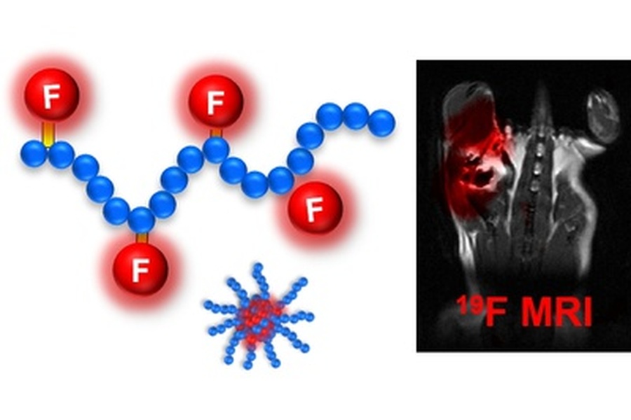 Fluorované polymery pro 19F MRI
